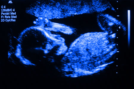 Roman Chavez: Sonogram